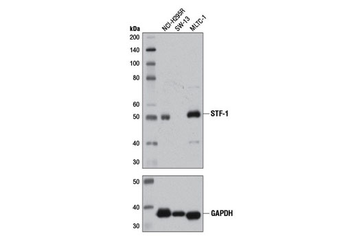STF-1 (D1Z2A) XP Rabbit mAb