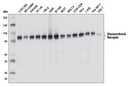 Glucocorticoid Receptor (D6H2L) XP Rabbit mAb