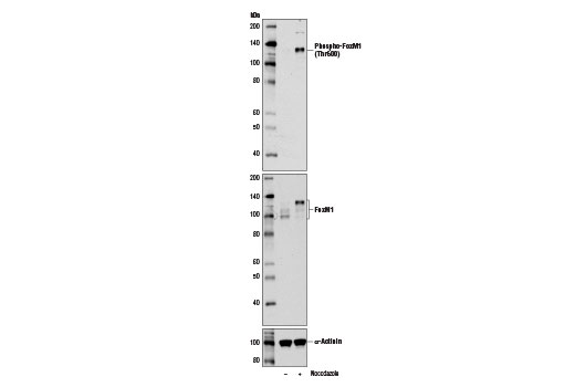 Phospho-FoxM1 (Thr600) (D9M6G) Rabbit mAb