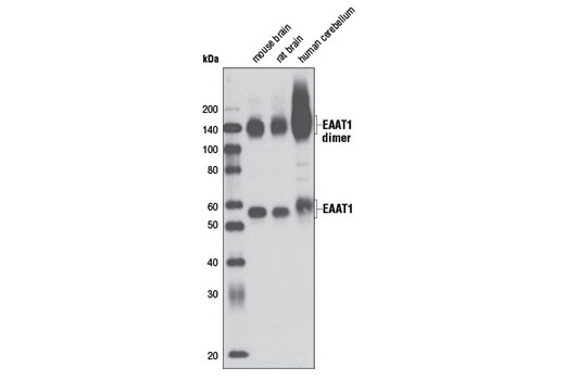 EAAT1 (D44E2) XP Rabbit mAb