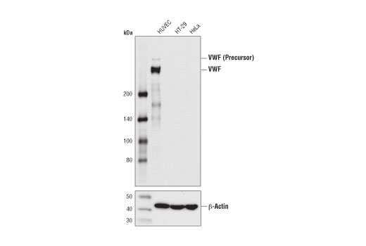 VWF (D8L8G) XP Rabbit mAb