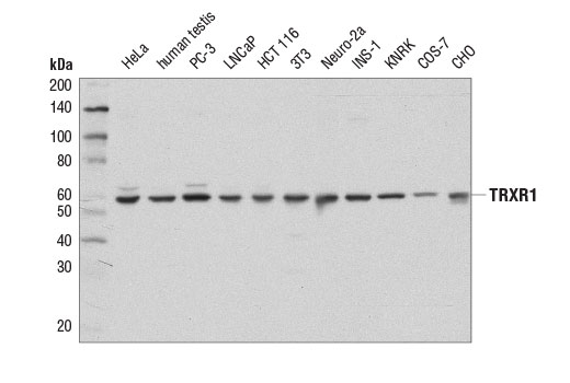 TRXR1 (D1T3D) Rabbit mAb