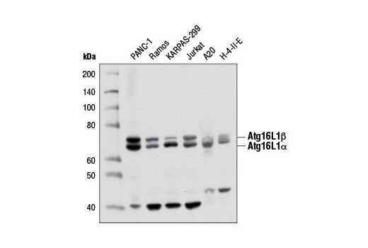 Atg16L1 (D6D5) Rabbit mAb