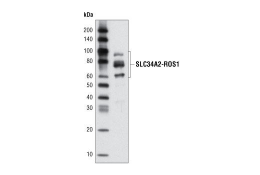 ROS1 (69D6) Mouse mAb