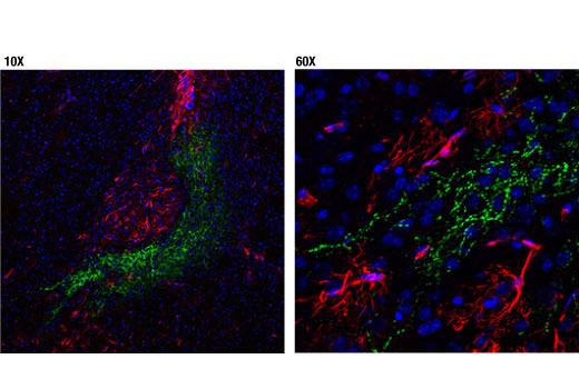 VIP (D8J1V) Rabbit mAb (IF Formulated)