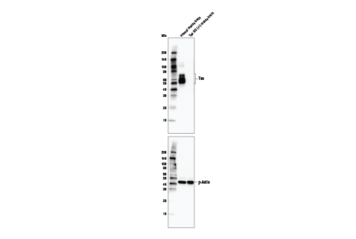 Tau (D1M9X) XP Rabbit mAb