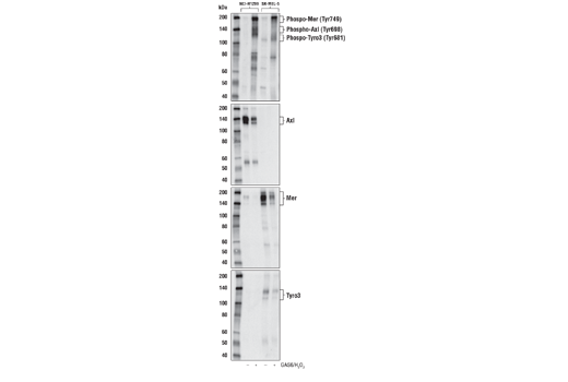 Phospho-Axl (Tyr698)/Mer (Tyr749)/Tyro3 (Tyr681) (D6M4W) Rabbit mAb