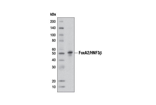 FoxA2/HNF3β (D56D6) XPRabbit mAb