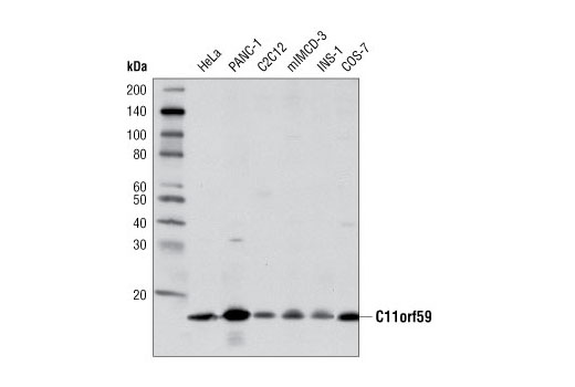 LAMTOR1/C11orf59 (D11H6) XP Rabbit mAb