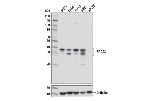 ERCC1 (D6G6) XP Rabbit mAb