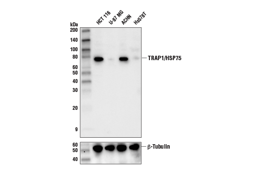 TRAP1/HSP75 (D3D7N) Rabbit mAb