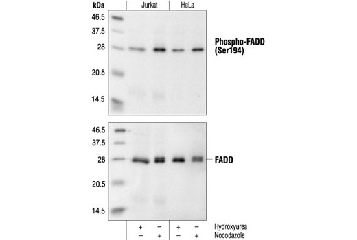 Phospho-FADD (Ser194) Antibody (Human Specific)