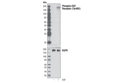 Phospho-EGF Receptor (Tyr992) Antibody