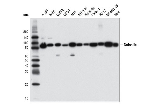 Gelsolin (D9W8Y) Rabbit mAb