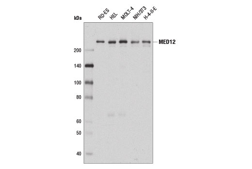 MED12 (D9K5J) Rabbit mAb