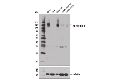 Anoctamin 1 (D1M9Q) Rabbit mAb