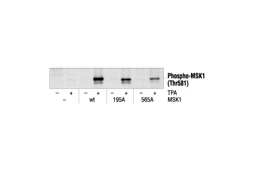 Phospho-MSK1 (Thr581) Antibody