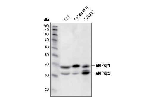 AMPKβ1/2 (57C12) Rabbit mAb