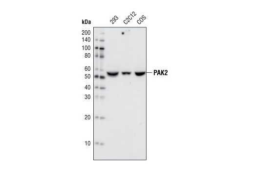 PAK2 (C17A10) Rabbit mAb