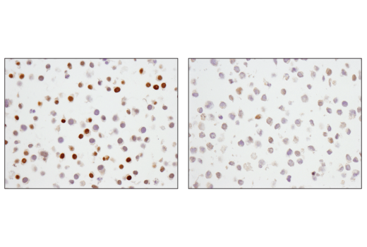 p27 Kip1 (SX53G8.5) Mouse mAb (IHC Formulated)