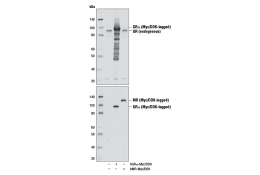 Glucocorticoid Receptor (D8H2) XP Rabbit mAb