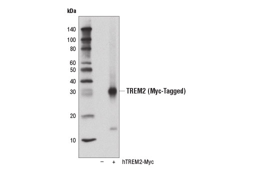 TREM2 (D8I4C) Rabbit mAb