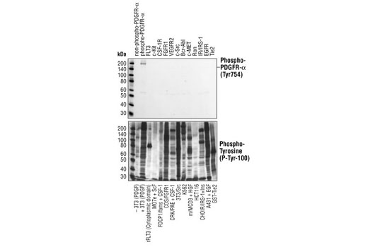PDGF Receptor α Antibody Sampler Kit