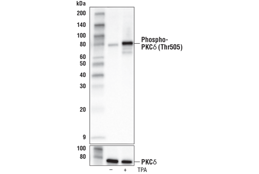 Phospho-PKCδ (Thr505) (D8K4R) Rabbit mAb