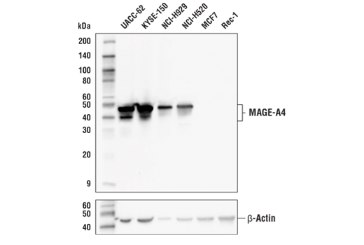 MAGE-A4 (E7O1U) XP Rabbit mAb
