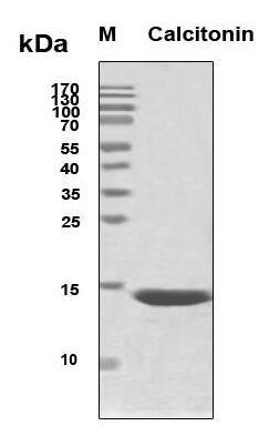 Recombinant Human procalcitonin (PCT)