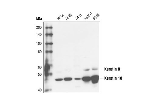 Keratin 8/18 (C51) Mouse mAb