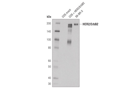 HER2/ErbB2 (44E7) Mouse mAb