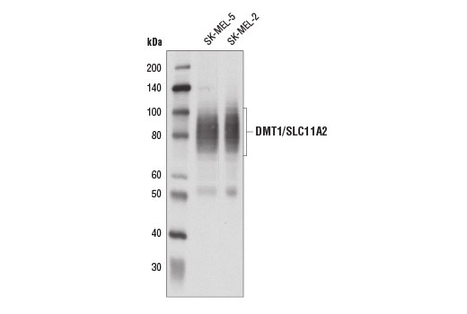 DMT1/SLC11A2 (D3V8G) Rabbit mAb