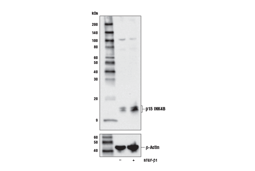 p15 INK4B (E3R6S) Rabbit mAb