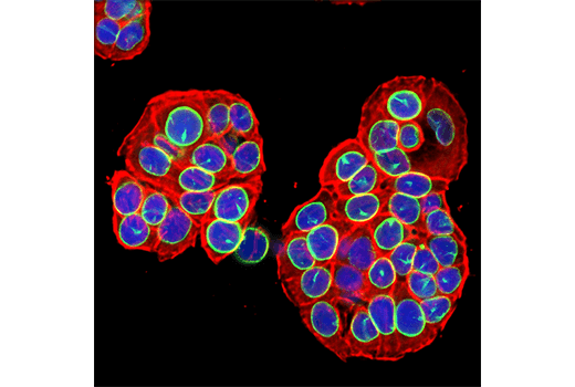 Lamin B1 (119D5-F1) Mouse mAb