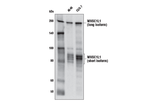 WHSC1L1 (D4N9N) Rabbit mAb