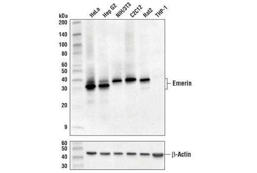 Emerin (D3B9G) XP Rabbit mAb