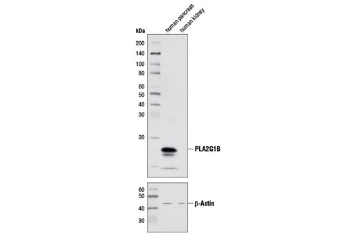 PLA2G1B Antibody