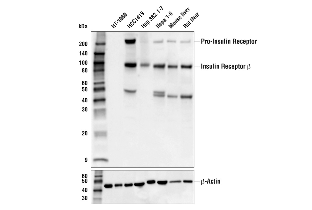 Insulin Receptor β (E9L5V) XP Rabbit mAb