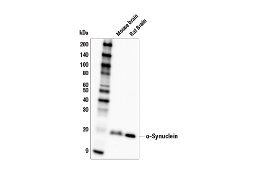 alpha-Synuclein (E4U2F) Rabbit Monoclonal Antibody