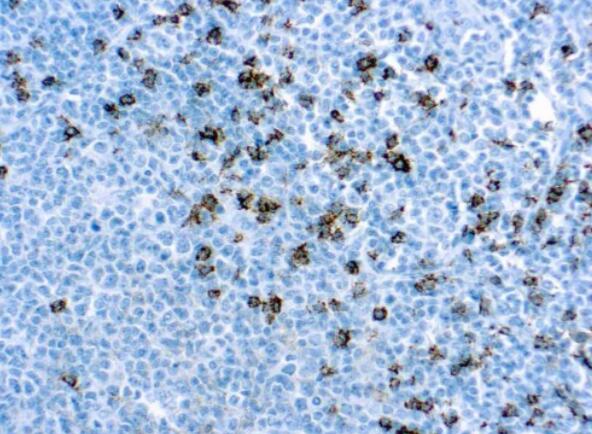 Anti-CD8 alpha抗体[C8/144B]