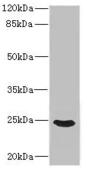 Anti-FGF19 antibody