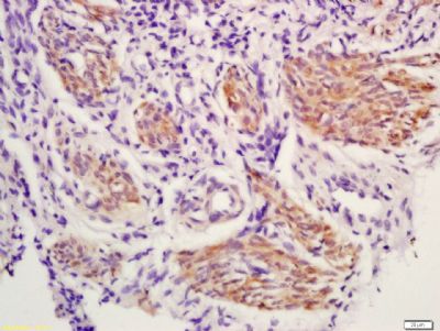 环氧合酶2/前列腺素内过氧化物合成酶2抗体