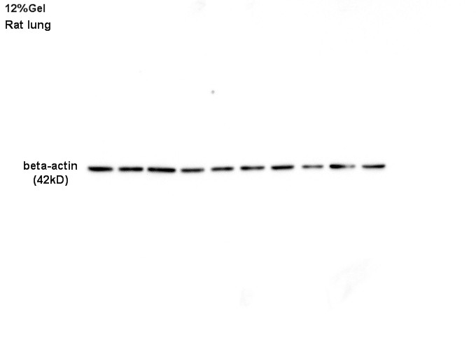 b-肌动蛋白/b-Actin（内参）抗体