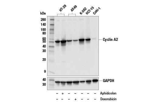 Cyclin A2 (E6D1J) XP Rabbit mAb