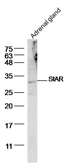 促黄体激素诱导蛋白抗体