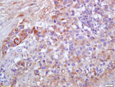 IV型胶原蛋白/4型胶原蛋白/胶原蛋白4抗体