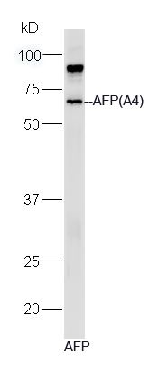 甲胎蛋白单克隆抗体（包被）