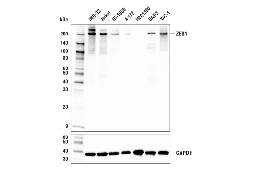 ZEB1 (E2G6Y) XP Rabbit mAb