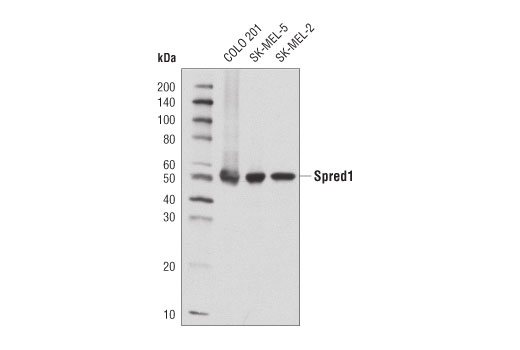Spred1 (D6D8B) Rabbit mAb